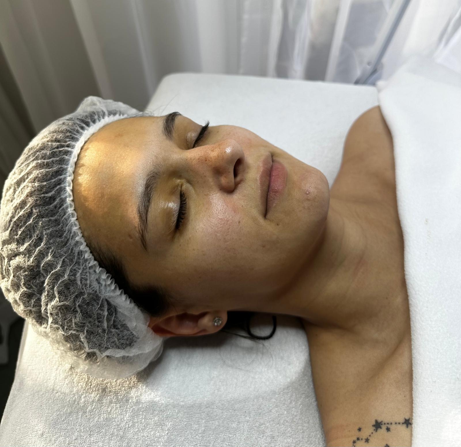 Tratament facial — etapa 1