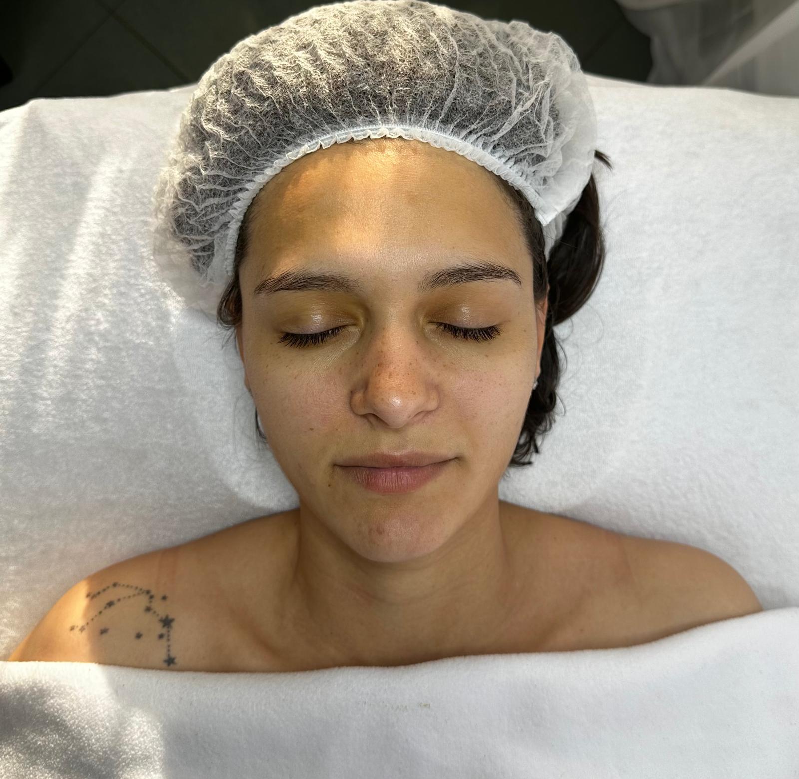 Tratament facial — etapa 2